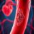 Choroby naczyniowe: przyczyny, objawy i metody diagnostyki
