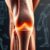 Jak skutecznie rehabilitować rzepkę? Przyczyny, objawy i metody лечения